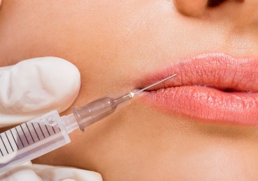 BOTOX AND THERMAL FILLING